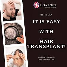 I'm part of the 50 percent you don't want to be in. Why Hair Transplantation Dr Genetrix