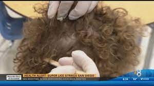 Health Alert Super Lice Strikes San Diego Cbs8 Com
