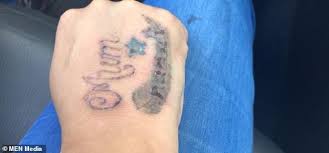 Question is, can you fully erase a tattoo? Customers Share Their Horrifying After Images As Their Skin Is Left Blistered And Burning Daily Mail Online