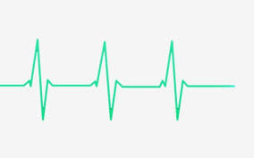 Rate Beat Electrocardiogram Heartbeat Clipart Heart Rate Heartbeat Png Transparent Image And Clipart For Free Download Clip Art In A Heartbeat Heart Rate