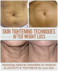 Losing Weight Is A Momentous Achievement And Ought To Be Celebrated For Sure But For Some Havi Sagging Skin Skin Tightening Stomach Skin Tightening Techniques