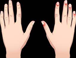 I have been getting my nails fine fit years. Irritated Cuticles After Manicure Allergic Reaction