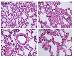Lung parenchyma is the substance of the lung outside of the circulatory system that is involved with gas exchange and includes the pulmonary alveoli and respiratory bronchioles,7. Light Microscopy Of The Lung Parenchyma Hhp Group A Moderate Download Scientific Diagram