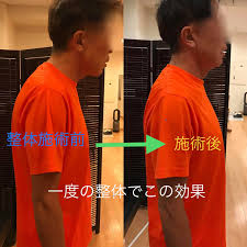 ストレートネックは治る 2 ストレートネック治療 治し方 公式 東京都中央区の整体院ピーク銀座のホームページ