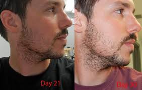 27yr Old First Beard Pics Updated Month 6 Page 4