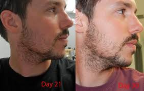 27yr old first beard pics updated month 6 page 4