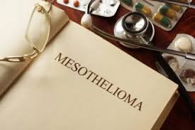 Signs of mesothelioma cancer will vary based on the type, stage and other factors. Mesothelioma Symptoms Recognizing The Early Signs Of Mesothelioma