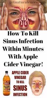 Aplicand acest remediu, am reusit sa calmez durerile si am scapat de nodulul foarte dureros. 76 Sinuzita Ideas SÄnÄtate Remedii Naturale Remedii Naturiste