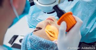 Ob und wann sich dabei auch fehlsichtigkeiten einstellen. Augen Lasern Methoden Risiken Kosten Netdoktor