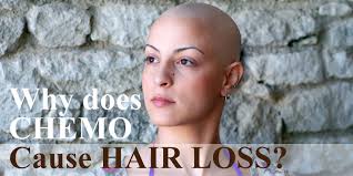 Hair loss occurs because chemotherapy targets all rapidly dividing cells—healthy cells as well as cancer cells. Why Does Chemo Cause Hair Loss Rebecca Wigspert Chemotherapy