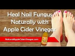 The reason for that is because of the acidic ph level that… Use Apple Cider Vinegar For Nail Fungus Natural Home Remedy For Toenails Fingernails Youtube