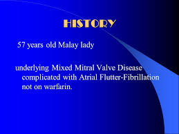Cancer research in malaysia has to consider needs rele … Points For Discussions Diagnosis History 57 Years Old Malay Lady Underlying Mixed Mitral Valve Disease Complicated With Atrial Flutter Fibrillation Not Ppt Download