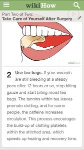 Pin On Healthy Living Remedies
