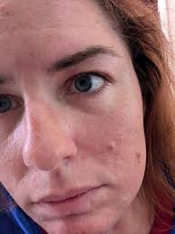 Any tips for unclogging stubborn pores?