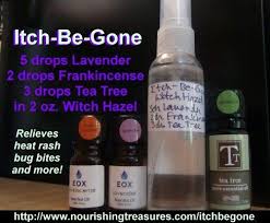 Itch Be Gone Essential Oil Recipe Relieves Heat Rash Bug Bites And More Nourishing Treasures Essential Oil Recipes Oil Recipes Essential Oils Bug Bites