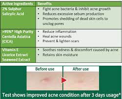 Acnes Medicated Sealing Jell Mentholatum Singapore