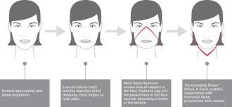 Braces can change your face shape and improve your overall look. Complete Dentures Get Complete Denture Set From Changing Faces