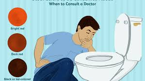 The advice is the same if you have diarrhoea and vomiting. Stool Color Changes What S Normal And What S Not