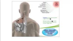 Free Trigger Point Charts Youtube
