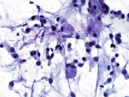 We did not find results for: Lung And Mediastinum Springerlink