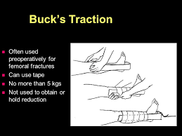 A patient in buck's traction should not turn from side to side. Traction In Orthopaedics Ppt Video Online Download