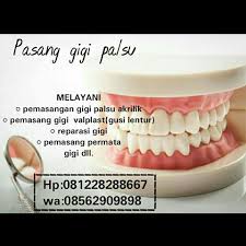 Maybe you would like to learn more about one of these? Melayani Jasa Pasang Gigi Palsu Dan Behel Gigi Facebook