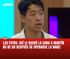 TREMENDO CAMBIO😳 😱 Martín Ku sorprendió con su nueva nariz operada,  desató revuelo en redes y anticipa cambios. Mira todas las fotos en nuestra  web:  https://www.paparazzi.com.ar/teve/las-fotos-asi-le-quedo-la-cara-a-martin-ku-de-gh-despues-de  ...