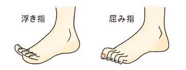 ふくらはぎを太くする歩き方とは ８つの原因とセルフチェックのやり方を徹底解説 脚やせクイーン ふくらはぎが太い女子の脚やせレシピ 脚やせ ダイエット 膝 ストレッチ ふくらはぎ