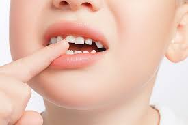The tooth is not big enough (unless it's a molar,then pull it out) to clog airways. Why You Shouldn T Pull Your Child S Loose Tooth Tisseront Orthodontics