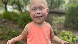 Sask. TikTok star 'Bella Brave' hospitalized after medical emergency,  condition 'stable': family