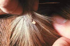 Creepy Crawlies Part 2 Tremendous Ticks The Horse