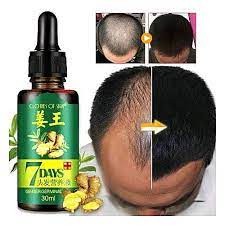 Best oil for dry scalp based on hair type. Hair Oil For Hair Growth