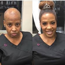 Great product! the sassy hair cap is an extremely unique extended satin bonnet that makes maintaining your hair's style and health easier. Untitled Alopecia Hairstyles Black Women Hair Loss Short Sassy Hair
