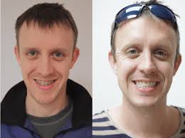 Expansion Orthodontics