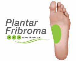 The lump may initially cause little to no pain or discomfort. Plantar Fibroma Slo Motion Shoesslo Motion Shoes