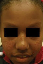 Barrett J. Zlotoff, MD