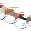 Maka dari itu, anda perlu mengetahui secara detail tentang apa itu hepatitis dan pengobatannya. 1