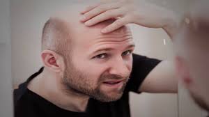 Protein is essential for hair growth, so a lack of healthy protein in your diet can cause broken hair strands that are resistant to growing back. 7 Worst Foods That Could Cause Hair Loss Youtube