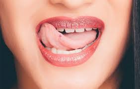 Canker Sores On Your Tongue Treatment Causes Teeth Talk Girl