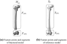 The walls of the diaphysis are composed of dense and hard compact bone. Reconstruction Individual Three Dimensional Model Of Fractured Long Bone Based On Feature Points Springerlink