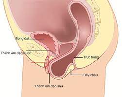 Ung thư trực tràng là một mối nguy hiểm nghiêm trọng, nhưng chẩn đoán sớm và. Sa Trá»±c Trang La Bá»‡nh Gi Nguyen Nhan Va Dáº¥u Hiá»‡u Nháº­n Biáº¿t Vinmec