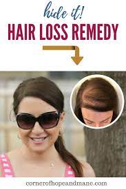 Hair Building Fibers Boostnblend Review Hair Loss Women Help Hair Loss Hair Loss Remedies