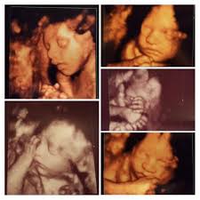 4d ultrasound pictures at 27 weeks. 4d Ultrasound At 27 Weeks Bad Time Babycenter