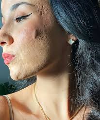 Maia Gray (@its_just_acne) • Threads, Say more