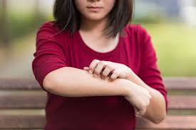 Agence de marketing industriel spécialisée dans le b2b. Eruption Cutanee Et Allergie Causes Symptomes Et Traitement