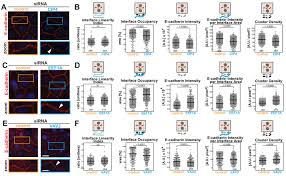 Only 1 available and it's in 1 person's cart. Junction Mapper Is A Novel Computer Vision Tool To Decipher Cell Cell Contact Phenotypes Elife