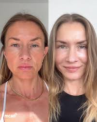 Marina's Rasional Holday: Sayıyorsun hasta 火 olcan MCAN için yapılan  mmaproveamin Mısırulu eğitncu danıştlinysan