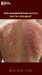 Image result for Skin Testing