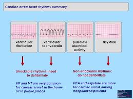 1reversible causes hypoxia hypovolaemia hypo/hyperkalaemia/metabolic hypothermia. Early Cpr Matters What About Early Defibrillation First Important To Understand Different Cardiac Arrest Rhythms Ventricular Fibrillation Heart Rhythm Ppt Download