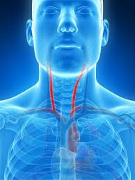 There are two large common carotid arteries, one on each side of the neck. Narrowing Of The Carotid Arteries May Lead To Memory And Thinking Problems